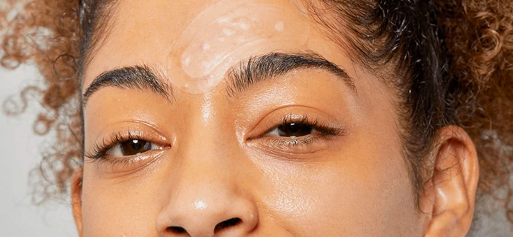 How To Get Rid Of Pimples On Forehead