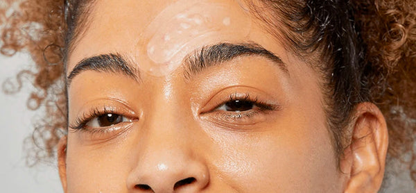 How to Get Rid of Stubborn Forehead Bumps