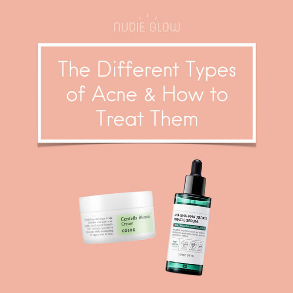What Type of Acne Do You Have? - The Different Types of Acne and How to Treat Them