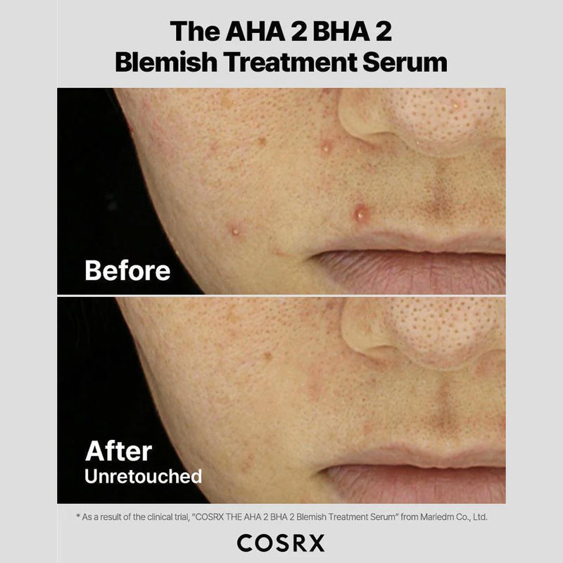 COSRX The AHA 2 BHA 2 Blemish Treatment Serum Nudie Glow Australia