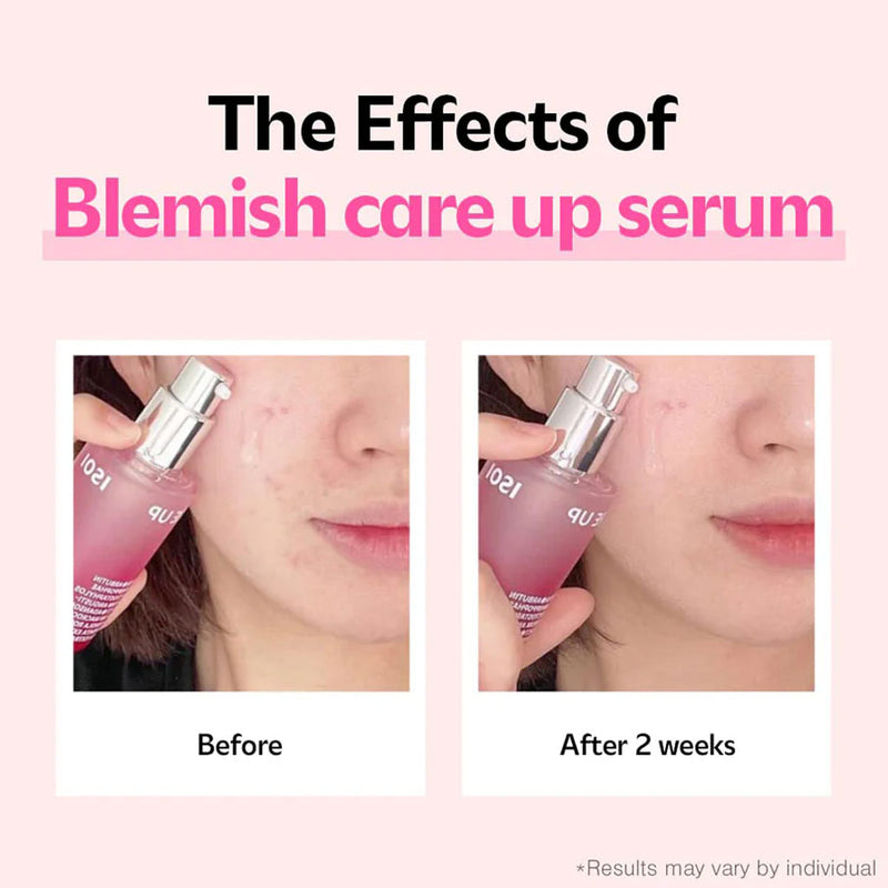 ISOI Blemish Care Up Serum Nudie Glow Australia