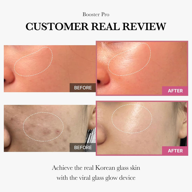 Age R Booster Mask Medicube AGE-R Booster Pro (PINK) - Nudie Glow Australia