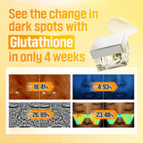 NUMBUZIN No.5 Vitamin Glutathione Dark Spot Laser Cream - Nudie Glow NUMBUZIN No.5 Vitamin Glutathione Dark Spot Laser Cream - Nudie Glow