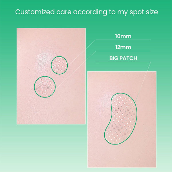 ilso No Problem Spot Patch Nudie Glow Australia