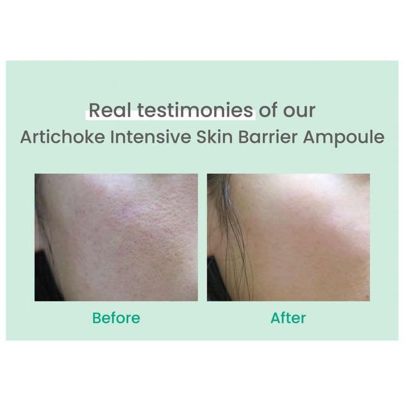 AXIS-Y Artichoke Intensive Skin Barrier Ampoule Before After