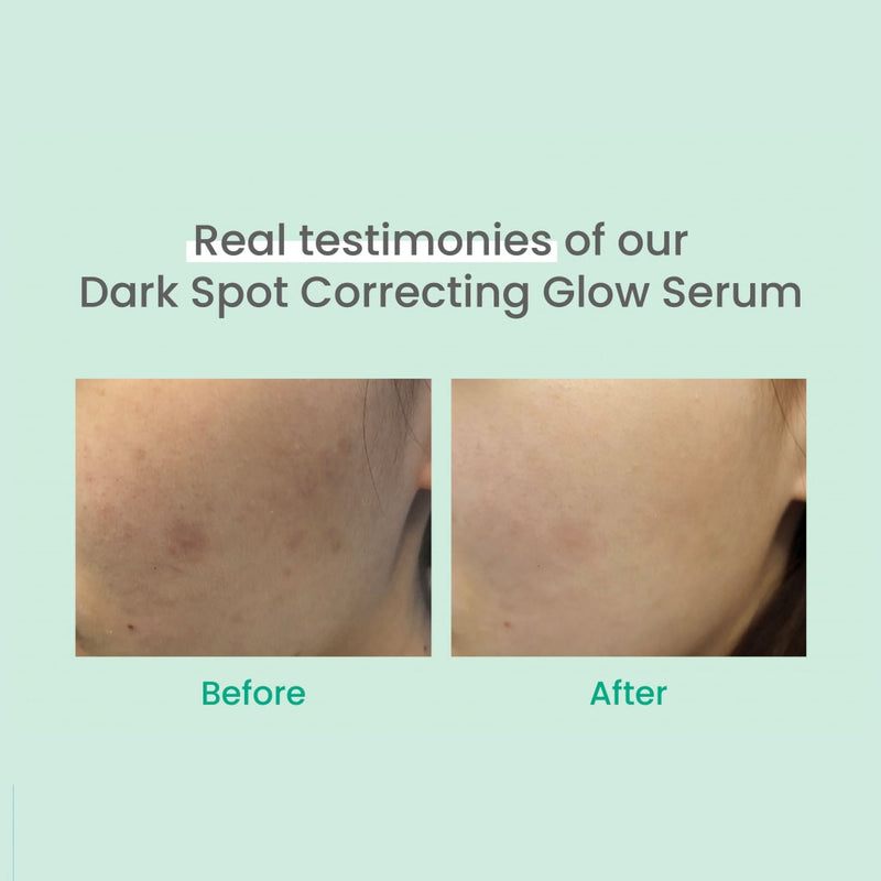 AXIS-Y Dark Spot Correcting Glow Serum Before After
