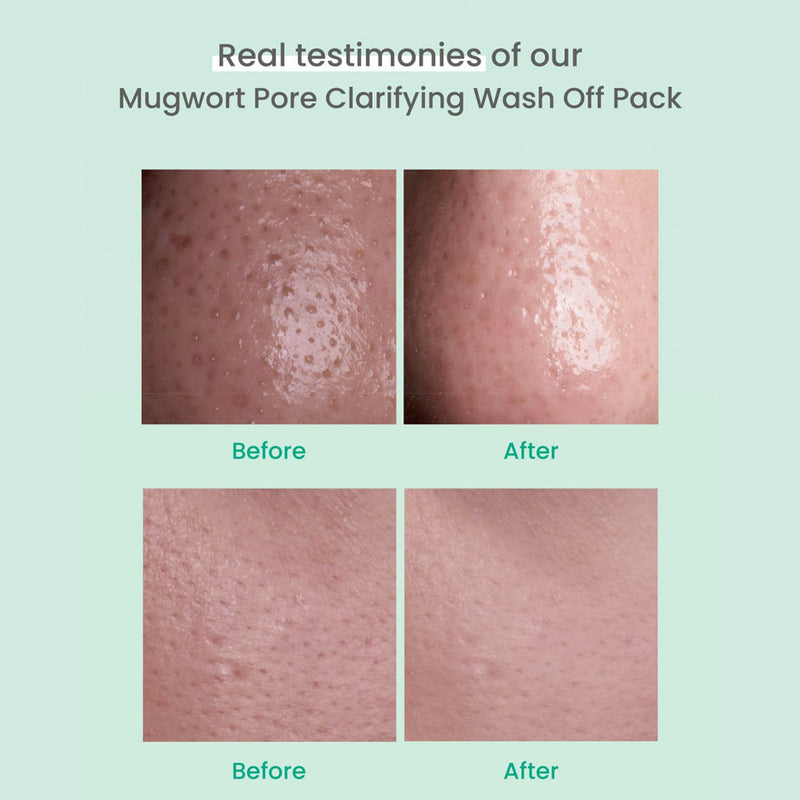 AXIS-Y Mugwort Pore Clarifying Wash Off Pack Before After