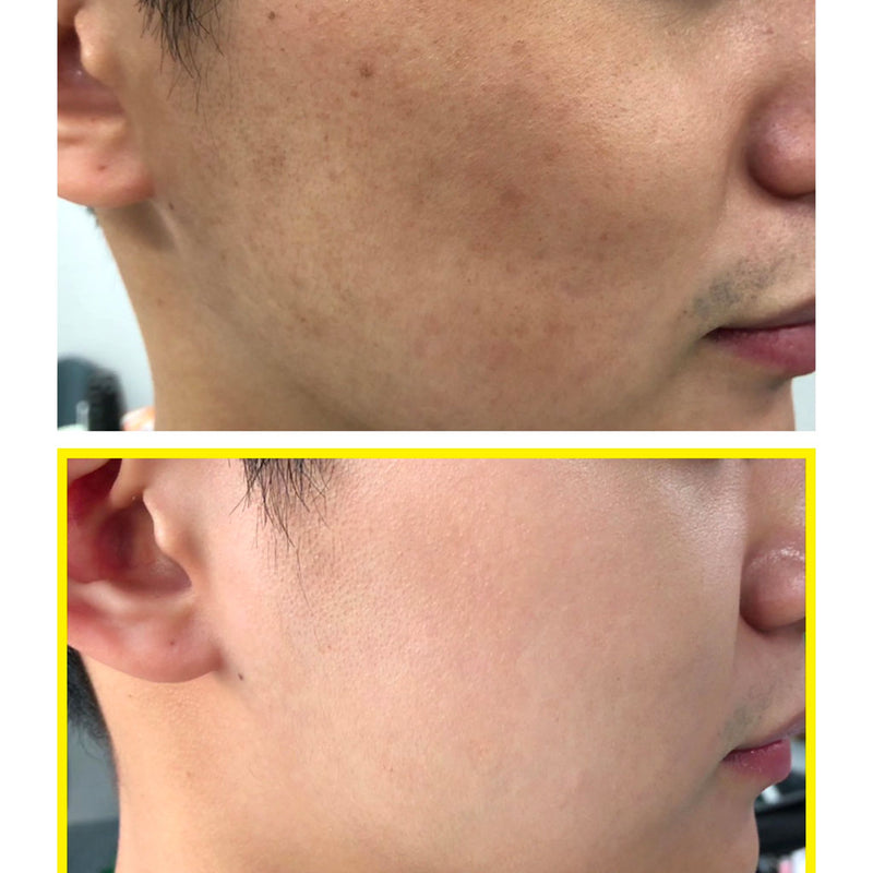 SOME BY MI Yuja Niacin 30 Days Miracle Brightening Toner Nudie Glow Korean Skin Care Australia Review