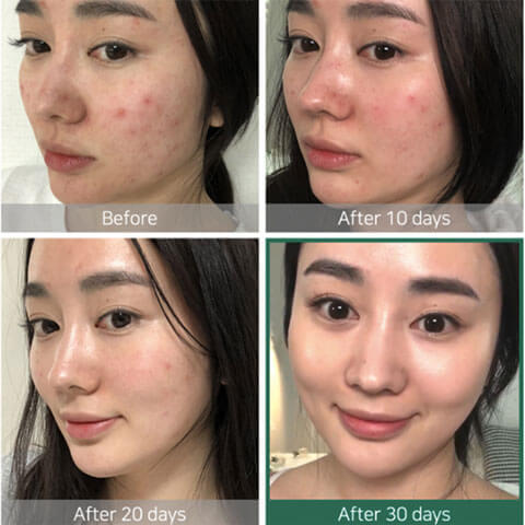 SOME BY MI AHA BHA PHA 30 Days Miracle Toner - Korean Beauty Skincare –  Nudie Glow