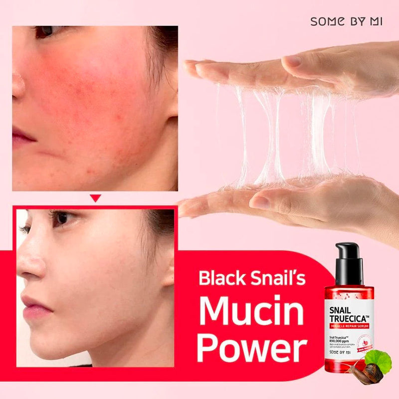 SOME BY MI Snail Truecica Miracle Repair Serum Nudie Glow Korean Skin Care Australia Before After Result Review